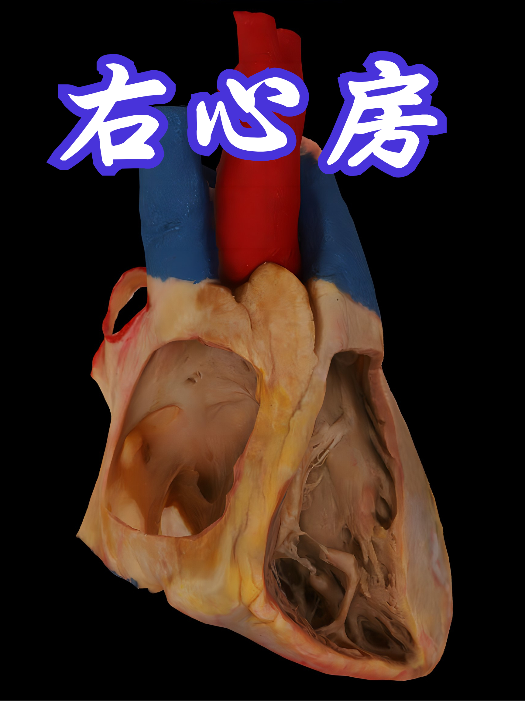 右心房的外形和内部结构 _腾讯新闻