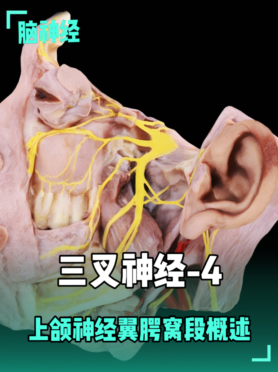 三叉神经-4：上颌神经：翼腭窝段概述 _腾讯新闻