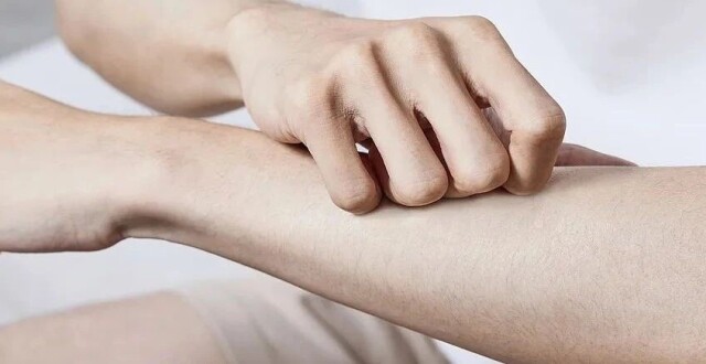 身上两处发痒，竟被确诊癌症！男子崩溃：以为是过敏_腾讯新闻