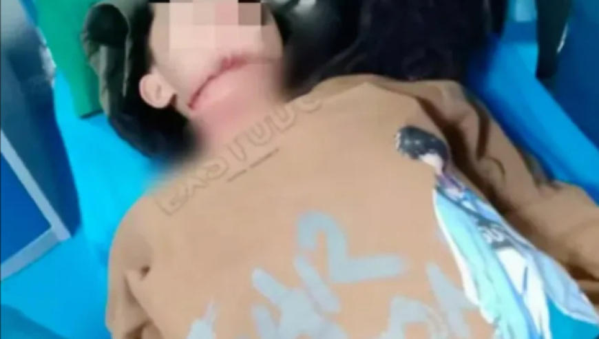 一根绳索为何成“隐形利刃”？颈部创伤急救与防护全指南