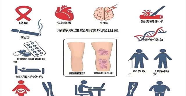 世界血栓日 | 血栓不是“梗”，预防才是关键_腾讯新闻
