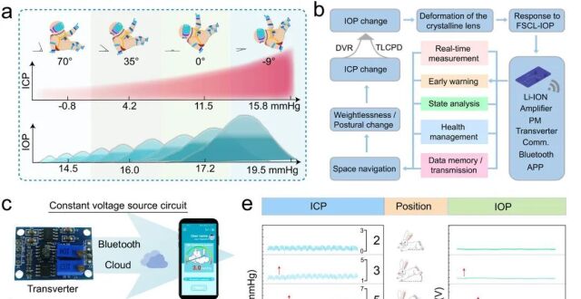 北京理工大学沈国震、李腊等《ACS Nano》：原位眼压监测系统用于无损实时颅内压监测！_腾讯新闻