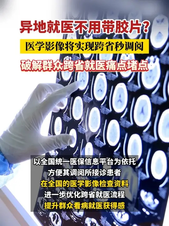 异地就医不用带胶片? 医学影像将实现跨省秒调阅，破解群众跨省就医痛点堵点_腾讯新闻