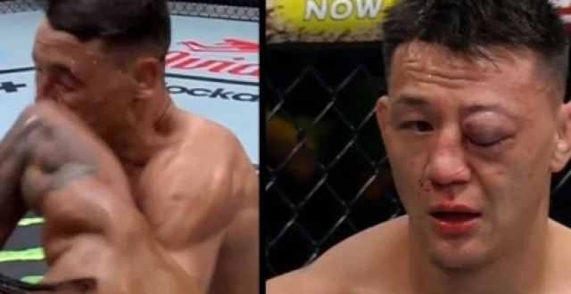 茸主再战UFC，眼睛遭遇恐怖暴击！_腾讯新闻