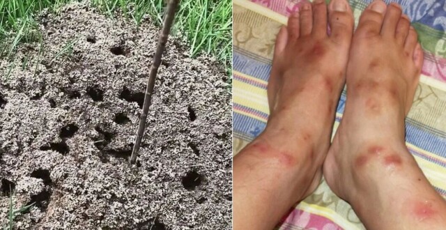警惕！看到这种“小土包”请立刻举报，成都已有多人因此过敏，严重可致命_腾讯新闻