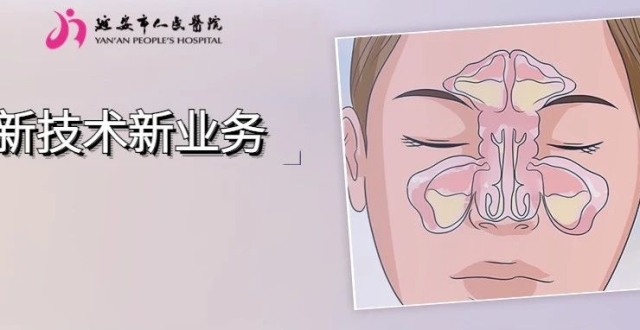 新技术新业务｜精准的电磁导航技术为鼻内镜手术保驾护航！_腾讯新闻