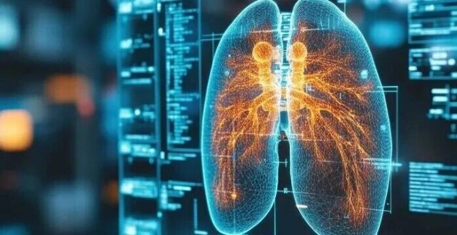 Cancer Cell重磅 | 从疗效到机制：Dato-DXd治疗晚期非小细胞肺癌的Ⅱ期临床研究_腾讯新闻