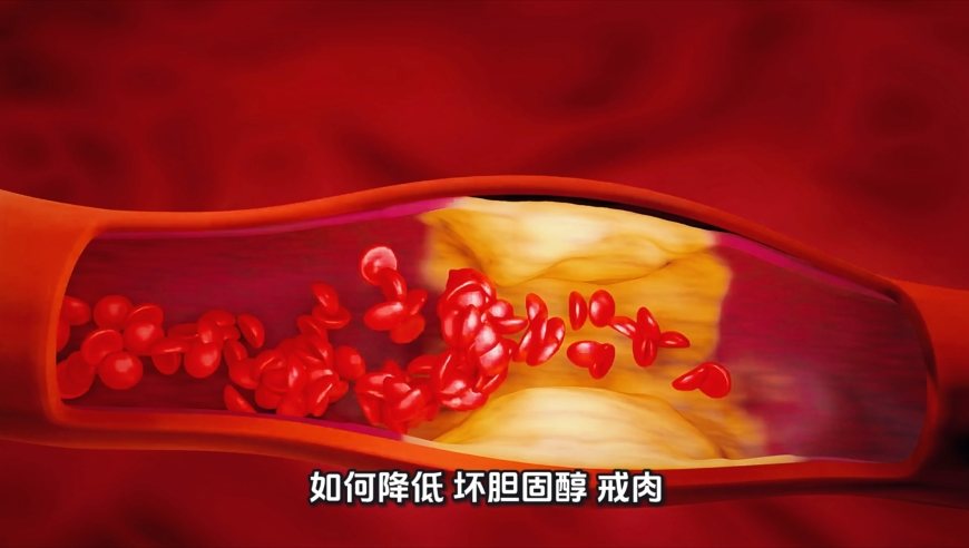 坏胆固醇高？研究：吃够这类优质蛋白，能降37%！