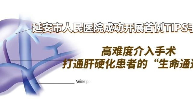 高难度介入手术打通肝硬化患者的“生命通道”——延安市人民医院成功开展首例TIPS手术_腾讯新闻