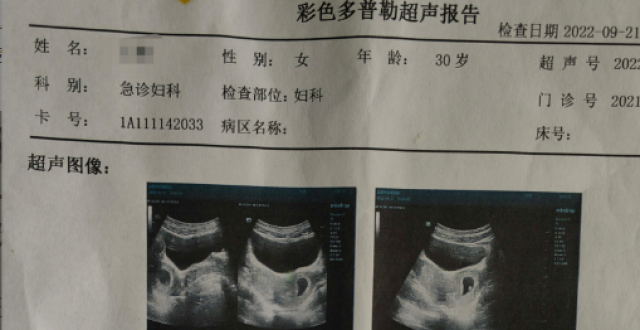 双子宫双宫颈孕 38 周，哪种分娩方式更好？_腾讯新闻