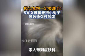 5岁女孩每天抱兔子感染脓癣，致永久性脱发，脓癣是什么病？有哪些早期感染信号可以识别？