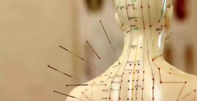 针灸真的能治失眠吗？医生用科学数据告诉你答案_腾讯新闻