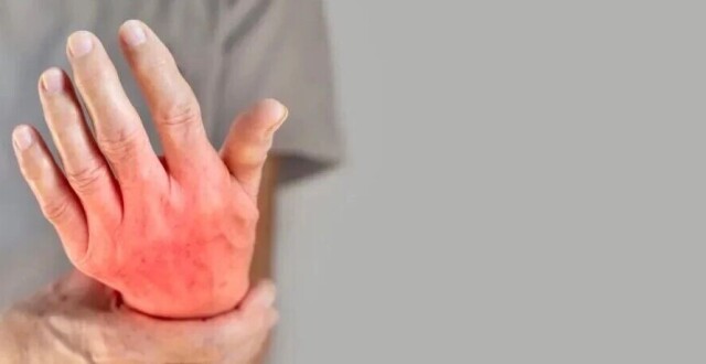 呈味核苷酸二钠是痛风“元凶”？缩略图